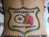 Tattoo - Tatuaje - tatuagem - Tatuaje de la Barra: Artillería Verde Sur • Club: Deportes Quindío